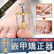 3爪嵌甲矯正器 指甲矯正器 腳趾甲矯正器