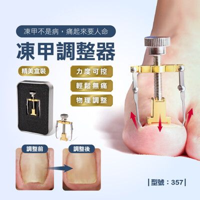 凍甲調整器/台灣現貨/甲溝炎/嵌甲調整器/糾正指甲/調整器/指甲內陷/無痛調整/型號:357【FAV